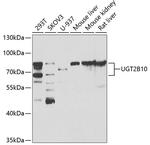 UGT2B10 Antibody in Western Blot (WB)