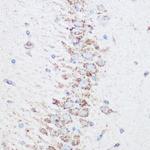 SIRT4 Antibody in Immunohistochemistry (Paraffin) (IHC (P))