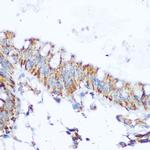 SIRT4 Antibody in Immunohistochemistry (Paraffin) (IHC (P))