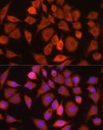 Bax Antibody in Immunocytochemistry (ICC/IF)