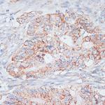 Desmoplakin Antibody in Immunohistochemistry (Paraffin) (IHC (P))