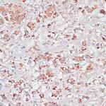 Desmoplakin Antibody in Immunohistochemistry (Paraffin) (IHC (P))