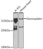 Desmoplakin Antibody in Western Blot (WB)