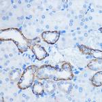 14-3-3 zeta Antibody in Immunohistochemistry (Paraffin) (IHC (P))