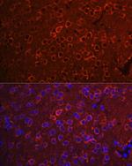 14-3-3 zeta Antibody in Immunohistochemistry (Paraffin) (IHC (P))