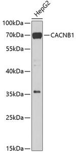 CACNB1 Antibody in Western Blot (WB)