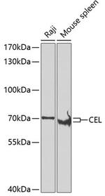 CEL Antibody in Western Blot (WB)