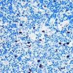 Chk1 Antibody in Immunohistochemistry (Paraffin) (IHC (P))