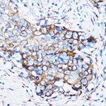 Chk1 Antibody in Immunohistochemistry (Paraffin) (IHC (P))