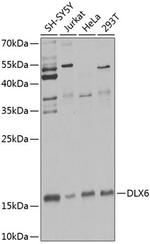 DLX6 Antibody in Western Blot (WB)