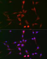 LOX Antibody in Immunocytochemistry (ICC/IF)