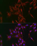 LOX Antibody in Immunocytochemistry (ICC/IF)