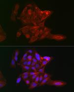 LOX Antibody in Immunocytochemistry (ICC/IF)