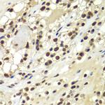 DNA-PK Antibody in Immunohistochemistry (Paraffin) (IHC (P))