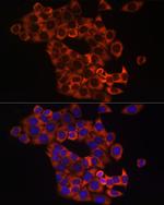 SHH Antibody in Immunocytochemistry (ICC/IF)