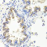 SHH Antibody in Immunohistochemistry (Paraffin) (IHC (P))