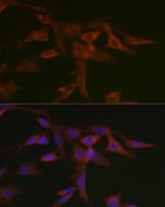 STAT5 alpha Antibody in Immunocytochemistry (ICC/IF)