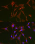 STAT5 alpha Antibody in Immunocytochemistry (ICC/IF)