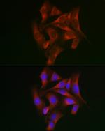 STAT5 alpha Antibody in Immunocytochemistry (ICC/IF)