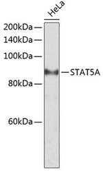 STAT5 alpha Antibody in Western Blot (WB)