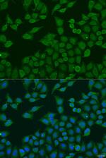 PLA2G4C Antibody in Immunocytochemistry (ICC/IF)