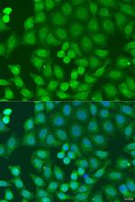 ZFYVE16 Antibody in Immunocytochemistry (ICC/IF)