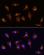 KDM5B Antibody in Immunocytochemistry (ICC/IF)