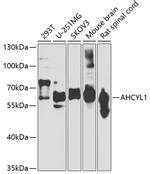 AdoHcyase 2 Antibody in Western Blot (WB)