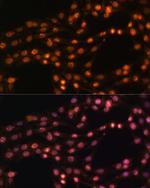 SUZ12 Antibody in Immunocytochemistry (ICC/IF)