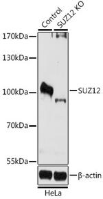 SUZ12 Antibody in Western Blot (WB)