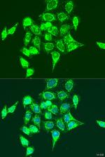 RASGRP3 Antibody in Immunocytochemistry (ICC/IF)