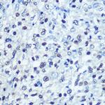 SAMHD1 Antibody in Immunohistochemistry (Paraffin) (IHC (P))