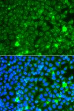 GBA3 Antibody in Immunocytochemistry (ICC/IF)