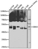 GBA3 Antibody in Western Blot (WB)