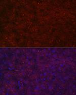 LRG1 Antibody in Immunocytochemistry (ICC/IF)