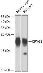 CRYGS Antibody in Western Blot (WB)