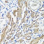 Filamin A Antibody in Immunohistochemistry (Paraffin) (IHC (P))