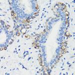 Filamin A Antibody in Immunohistochemistry (Paraffin) (IHC (P))