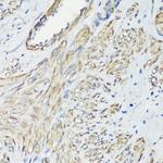 Filamin A Antibody in Immunohistochemistry (Paraffin) (IHC (P))