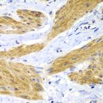 H-Ras Antibody in Immunohistochemistry (Paraffin) (IHC (P))