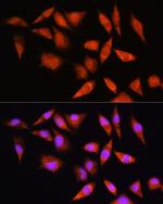 HSPA2 Antibody in Immunocytochemistry (ICC/IF)