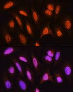 HSPA2 Antibody in Immunocytochemistry (ICC/IF)