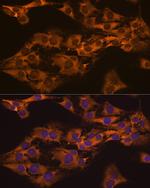 GPIP137 Antibody in Immunocytochemistry (ICC/IF)