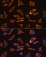 GPIP137 Antibody in Immunocytochemistry (ICC/IF)