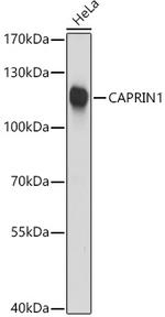 GPIP137 Antibody in Western Blot (WB)