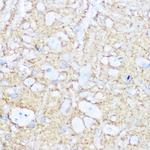 CD56 Antibody in Immunohistochemistry (Paraffin) (IHC (P))