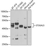 ST3GAL5 Antibody in Western Blot (WB)