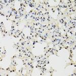 JMJD2A Antibody in Immunohistochemistry (Paraffin) (IHC (P))