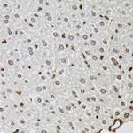 JMJD2A Antibody in Immunohistochemistry (Paraffin) (IHC (P))