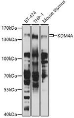 JMJD2A Antibody in Western Blot (WB)